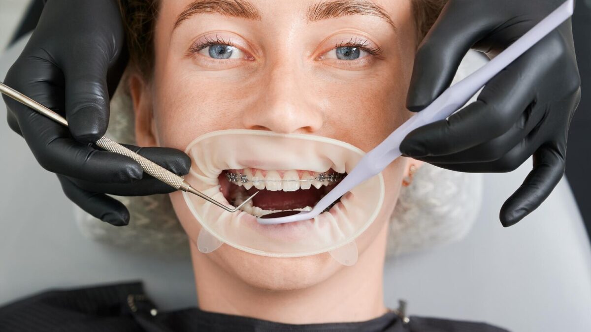 macro photography beautiful girl with braces dental clinic 651396 3441