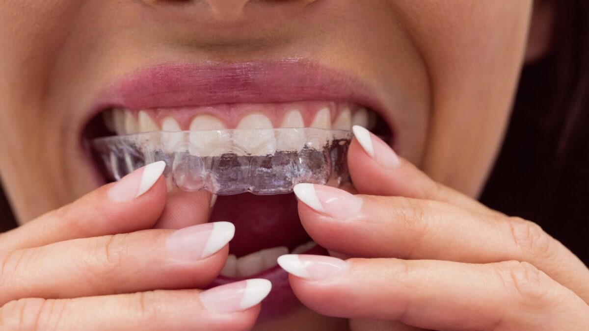 Ortodoncja Cyfrowa - Nowoczesna Metoda Poprawy Uśmiechu