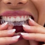 Ortodoncja Cyfrowa - Nowoczesna Metoda Poprawy Uśmiechu